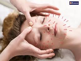 Acupuncture for Anxiety and Stress