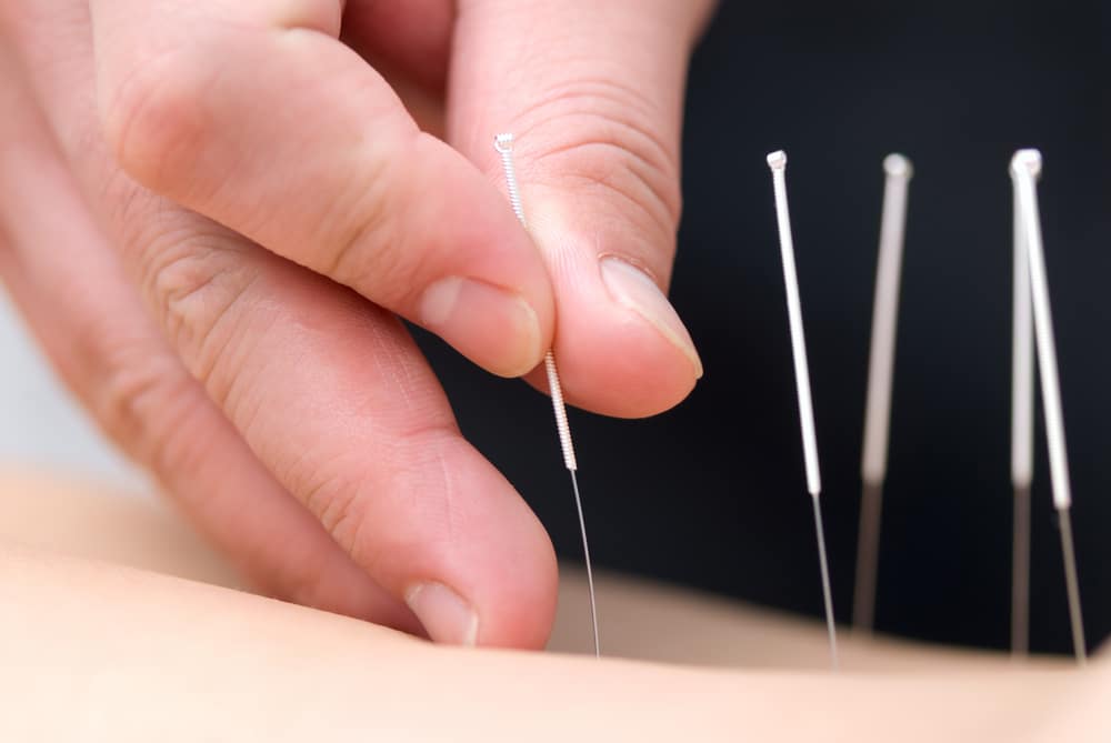 How Does Acupuncture Work